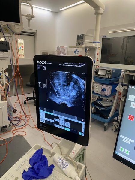 NanoKnife ultrasound monitor in theatre